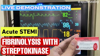 Fibrinolysis with streptokinase in acute STEMI  fibrinolisis pada STEMI serangan jantung berat [upl. by Esli662]