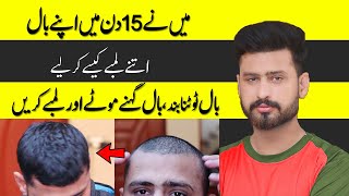 How I Grow My Hair Very Fast In Just 15 Days  How To Growth Hair Very Fast At Home [upl. by Artimed]