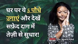 Grow These 5 Plants At Home For Faster Vitiligo Recovery [upl. by Ayvid863]