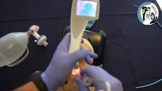 Intubación con Videolaringoscopio IVIEW de Intersurgical [upl. by Conlen513]