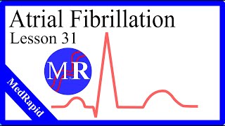 Atrial Fibrillation [upl. by Sedecrem388]