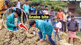 Guddu Maurya snake bite video घायल नाग नागिन का जोड़ा बचाते वक्त Cobra ने काटा जाना पड़ा अस्पताल [upl. by Kamila]