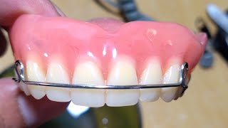 Pustiso with Retainer or Denture with Retainer [upl. by Bergstrom434]