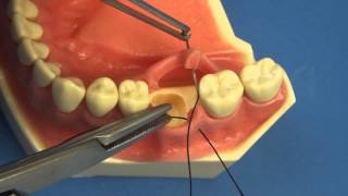 LEARN TO SUTURE THE EASY WAY  Surgical Technique  Interrupted Buccal Suturing  Dental  Medical [upl. by Ysteb]