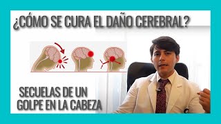 Recuperación después de un golpe en la cabeza Rehabilitación del traumatismo craneoencefálico [upl. by Letnohc242]