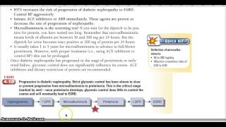 Learn With Me Diabetic Nephropathy Microalbuminuria Proteinuria [upl. by Dukie]