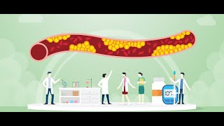 Course Outline for Studying Dyslipidemia [upl. by Etnauq432]