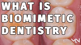 What is Biomimetic Dentistry Summary amp Benefits [upl. by Veronika5]