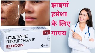 Elocon Cream Benefits  दाग धब्बे मिटाने की सबसे असरदार क्रीम  elocon cream review in hindi [upl. by Nauqaj]