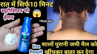 सालों पुरानी जमी मैल मिंटो में करें।।Skin care।। [upl. by Yatnwahs679]