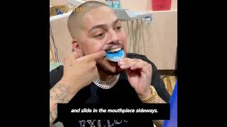 AporroHow to molding your Grillz by yourself [upl. by Yhtuv888]