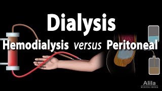 Renal Replacement Therapy Hemodialysis vs Peritoneal Dialysis Animation [upl. by Suivatnod6]