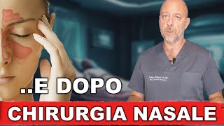 Dopo la chirurgia endoscopica nasale [upl. by Alcina669]