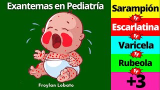 Exantemas en Pediatría ¡Fácil y completo👶 Escarlatina Sarampión Rubeola Varicela Kawasaki etc [upl. by Lorne536]