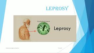 Leprosy  Definition Types Causes Signs and Symptoms Investigation and Management [upl. by Aja]