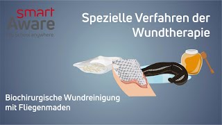 Wundreinigung  So wirken spezielle Methoden der Wundheilung von Medizinalhonig bis Fliegenlarven [upl. by Ttimme]