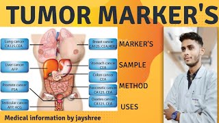 Tumor Markers  Cancer Markers  Cancer Diagnosis amp monitoring  Medical Information  byjayshree [upl. by Suedaht518]