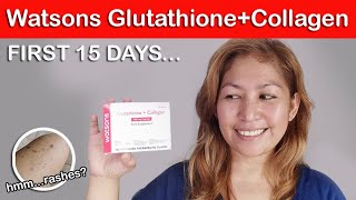 WATSONS GLUTATHIONE  COLLAGEN REVIEW  15 Days After [upl. by Eittocs792]