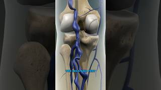 What causes varicose veins 3D Animation [upl. by Amaleta]