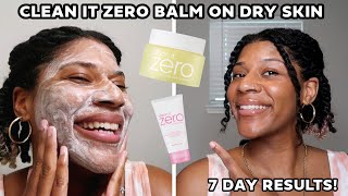 7 Days with Banila Co Clean It Zero Balm Review amp Results [upl. by Aicirtal]