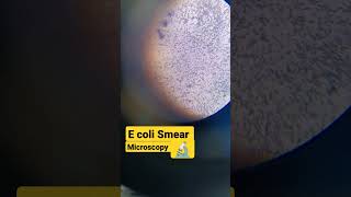 Microbiology E  coli microscope 🔬 picture 🖼️🖼️ microscopy edit youtubeshorts short trending [upl. by Dinsmore549]