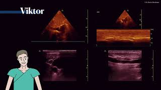 Der Volumenstatus im Ultraschall Einleitung amp Hyper vs Hypovolämie 〖Ultraschall〗 💘💫 [upl. by Ikram]