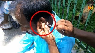 ►WOW  Amazing Street Ear Cleaning in Bangladesh II Incredible Poisonous Ear Wax II Street Life BD [upl. by Randene]