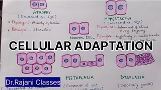 Cellular Adaptation  Pathology l Atrophy l Hypertrophy l Hyperplasia l Metaplasia l Dysplasia l [upl. by Anedal]