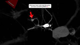 Brain cell restructures itself after forming a new connection neuroplasticity neuroscience brain [upl. by Gunilla118]