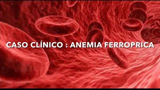 Caso Clínico Bioquímica  Anemia ferropriva [upl. by Jacinta481]