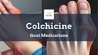 colchicine  Uses Dosage Side Effects amp Mechanism  Colcrys [upl. by Yelsa]