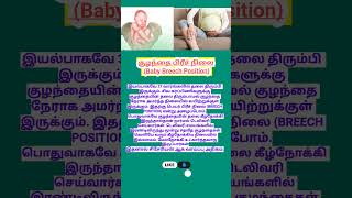 குழந்தை பிரீச் நிலை  baby breech position  baby position during pregnancy  breech  pregnancy [upl. by Nettie]