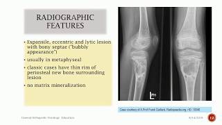 Aneurysmal Bone Cyst [upl. by Adnohsek]