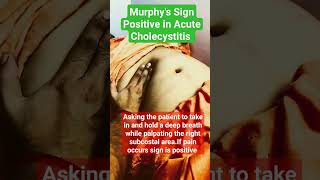 Murphys Sign  Acute Cholecystitis learning medicalstudent bams mbbs shorts viral [upl. by Trude872]