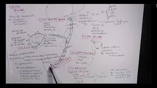 MEJOR EXPLICACIÓN COLELITIASIS COLECISTITIS COLEDOCOLITIASIS COLANGITIS [upl. by Toy283]