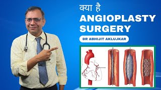 क्या है angioplasty surgery  What is Angioplasty  Dr Abhijit Aklujkar  Cordis Heart Institute [upl. by Lati434]