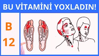 VACİB Halsızlıq yorğunluq varsa B12 vitamini çatışmır [upl. by Epolulot111]