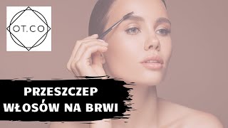 Przeszczep Brwi jak zrobić piękniejsze brwi  OTCO Clinic [upl. by Airamalegna]