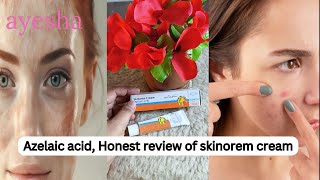 How to Use Azelaic Acid 20 benefits of azelaic acid Skinoren Cream Review in Pakistan [upl. by Kathlin]