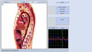 Prueba final de que el Metatron Metapathia GR Hunter 4025 y el 9d bioplasm nls parte 2 [upl. by Ytsur]