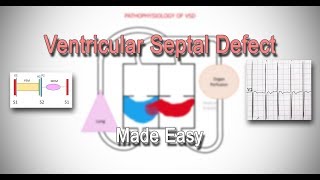 AV CANAL DEFECT  ATRIOVENTRICULAR CANAL DEFECT  Congenital Heart Disease  The Nurses Station [upl. by Ennairek]