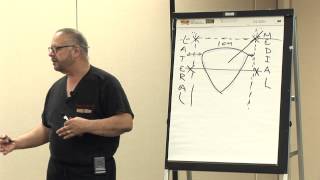 6 Intra Articulate Injection Points of the Knee by Dr Ernest Roman  Empire Medical Training [upl. by Essa607]