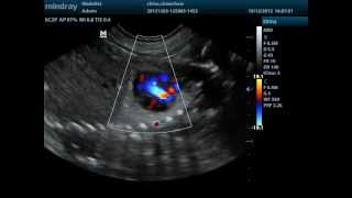 Doppler cardiaco fetal canino [upl. by Nnuahs]