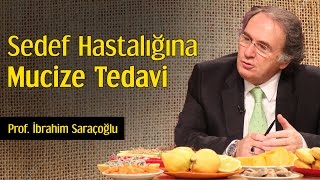 Sedef Hastalığına Mucize Tedavi  Prof İbrahim Saraçoğlu [upl. by Ainsworth]