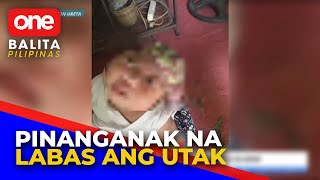 Anencephalic baby nabuhay lang sa loob ng 24 araw [upl. by Mel844]