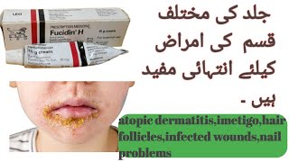 Fucidin H cream fusudic acid use for atopic dermatitis and many more skin problems detalis in urdu [upl. by Avenej]