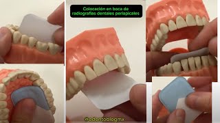 Colocación en boca de radiografías dentales periapicales para toma de radiografías [upl. by Marsden]