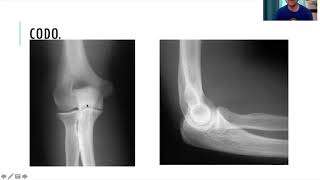 Radiología simple de miembro superior [upl. by Chap]