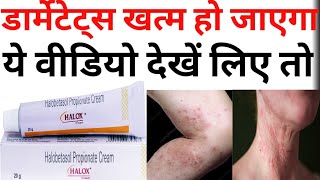 Haloxcream Halobetasol Propionate in hindi Use Profit Sideeffectsby offlineboymedico [upl. by Notxarb]