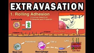 EXTRAVASATION [upl. by Allyn]